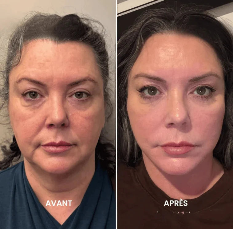 Orvani - Brosse de drainage lymphatique